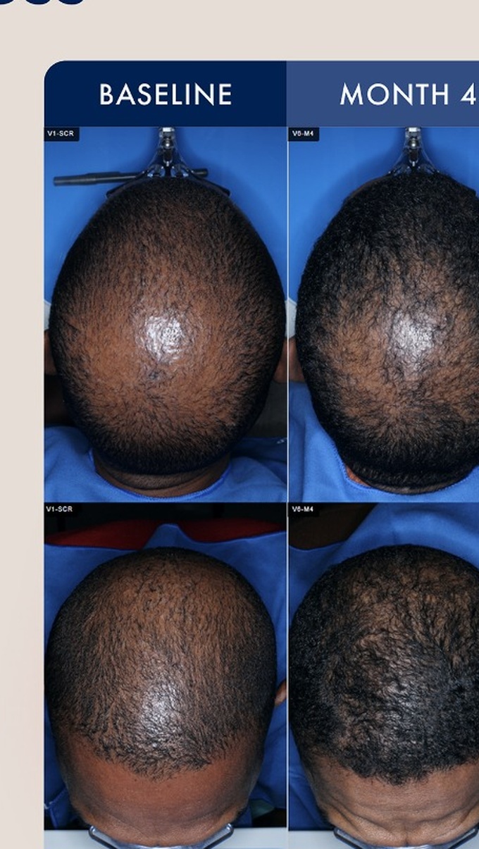 Source photographic comparisons, male cohort example 3