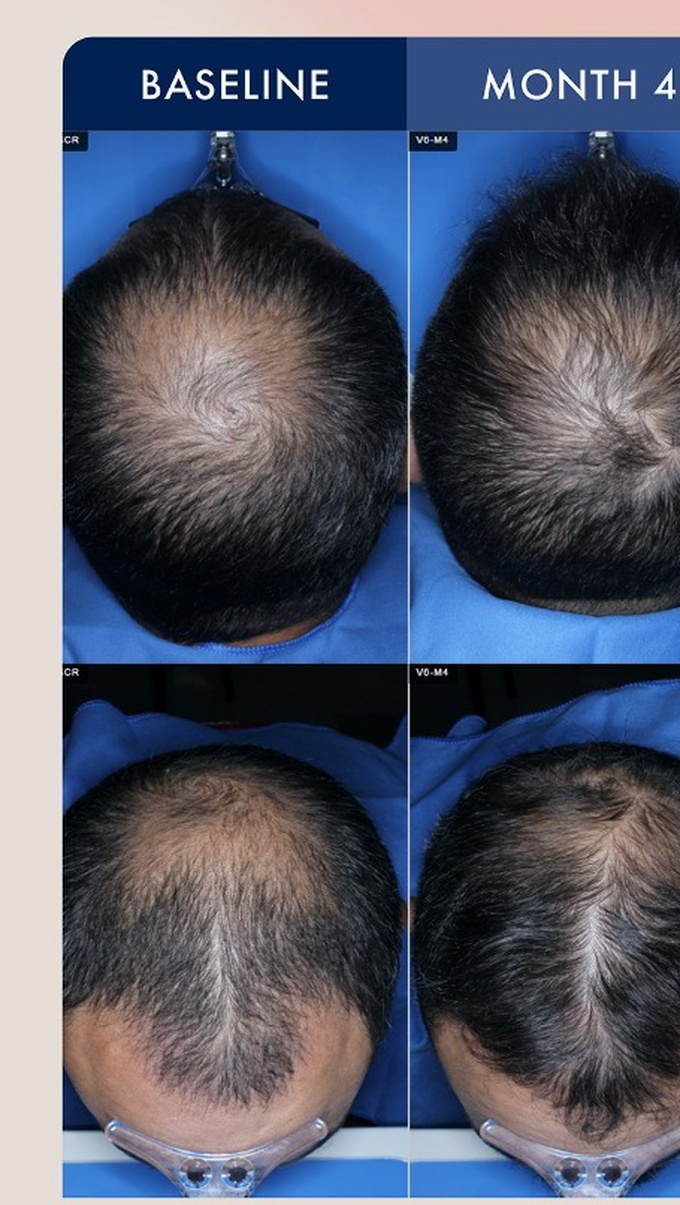 Source photographic comparisons, male cohort example 6